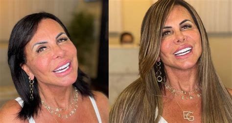 Gretchen Antes E Depois 2025 - Gretchen faz antes e depois de novo visual e fãs elogiam