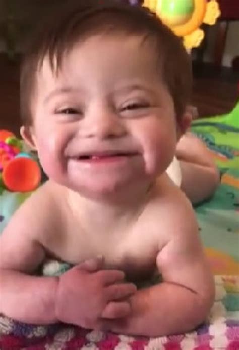 Bebê com síndrome de Down dá primeiro sorriso para mãe e derrete