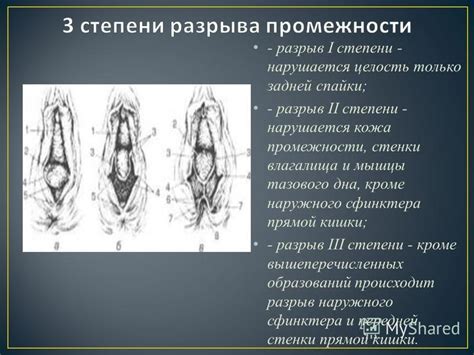 Презентация на тему: "Подготовила : Шуганова А. Г.. Повреждение мягких ...