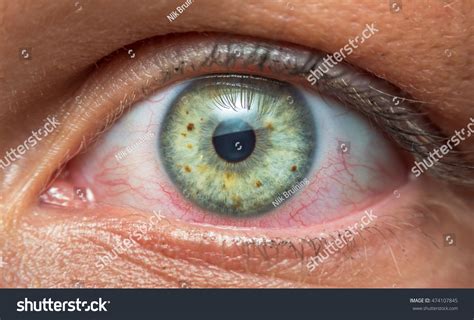 Human Eye Blood Vessels Stock Photo 474107845 | Shutterstock