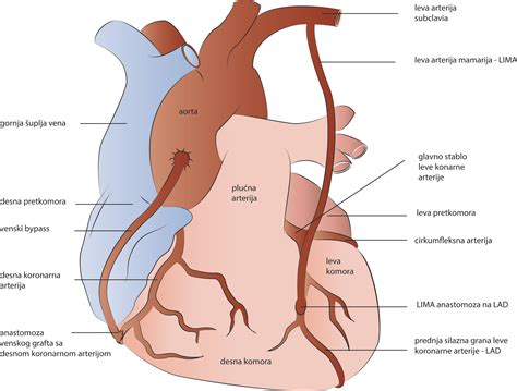 Aortokoronarni Bajpas - Kardiohirurgija.rs