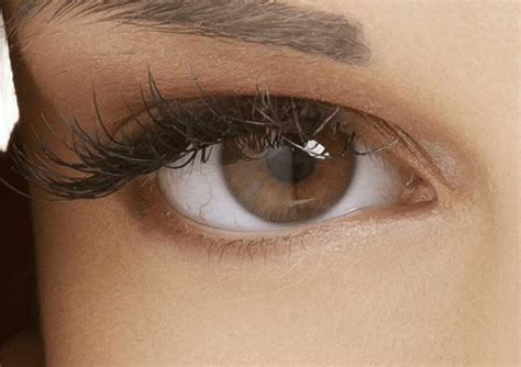 Lower Eyelid Surgery Candidates - The Eyelid Institute