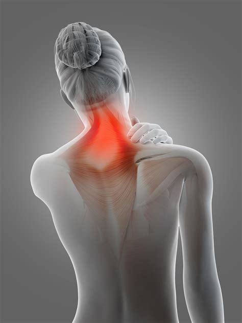 Καταπολεμήστε το αυχενικό με 3 απλές φυσικές συνταγές - Lady Secret