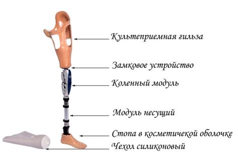 Современные протезы бедра модульного типа с креплением на силиконовый ...