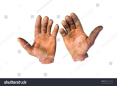 worker showing  chapped hands dirty stock photo  shutterstock