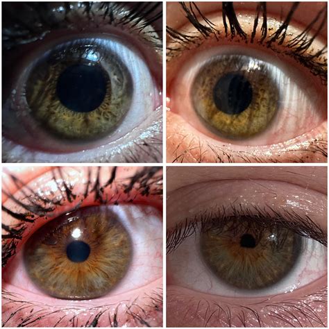 Understanding the genetics behind different shades of hazel eyes 2