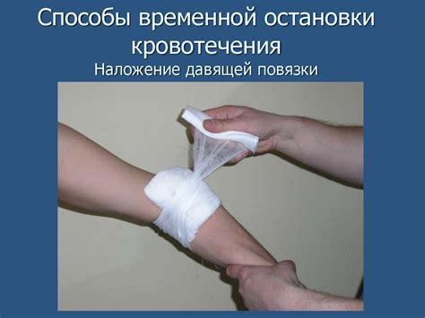 Кровотечение, кровопотеря - презентация онлайн