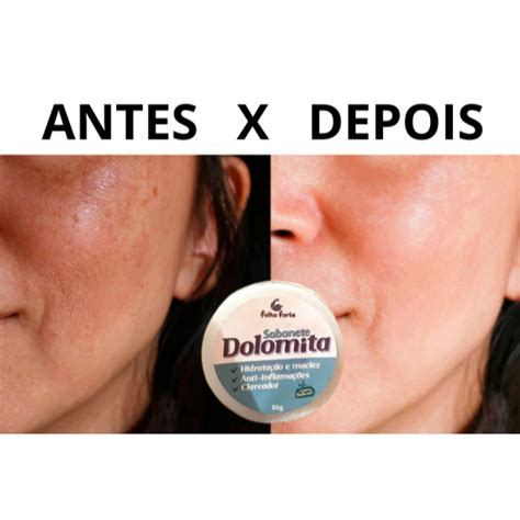 Dolomita Clareia A Pele Em Quanto Tempo - KIT SABONETE CLAREADOR NATURAL DOLOMITA, CLAREIA A PELE, REMOVE ACNE ...