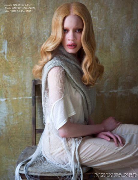 Diandra Forrest – Afro-American Albino Model | Celebrities