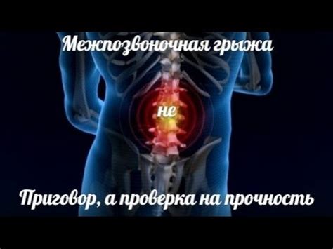 Межпозвонковая - МЕЖПОЗВОНОЧНАЯ ГРЫЖА! КАК ТРЕНИРОВАТЬСЯ С ГРЫЖЕЙ, КАК ...