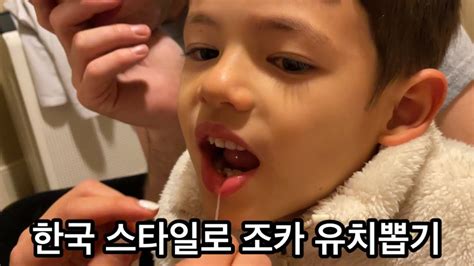 미국혼혈 조카 첫 유치 뽑기🦷 | Korean Style Tooth Extraction - YouTube