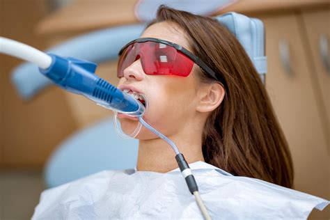 How Does Laser Teeth Whitening Work? - Safety & Costs