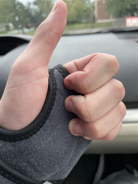 588 best Tendon images on Pholder | Neverbrokeabone, Japanese Food and