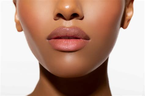 How Long Does Lip Filler Bruising *Really* Last