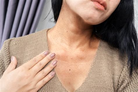 acanthosis nigricans treatment pictures   erdem hospital