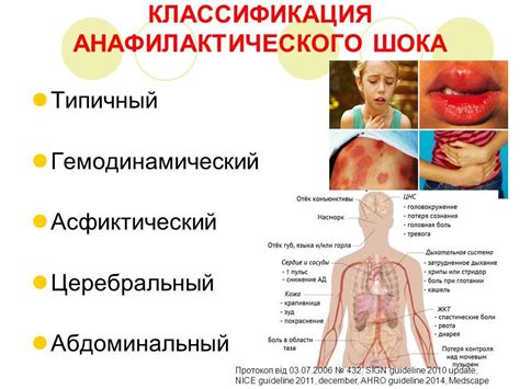 Анафилактический шок: причины, симптомы, неотложная помощь