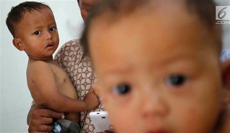 foto melihat kondisi anak anak kurang gizi  pandeglang foto