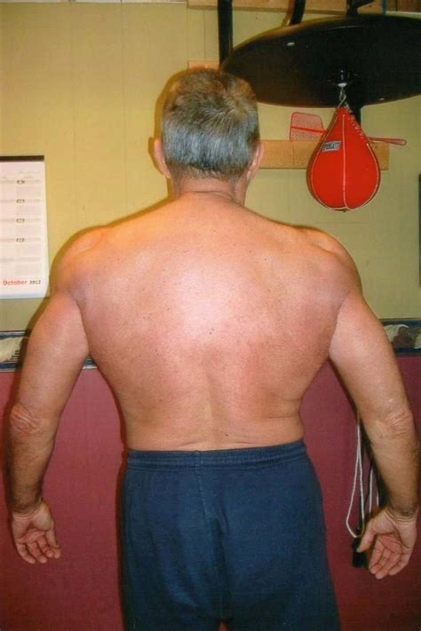 Are You Skinny-Fat? A Comprehensive Description of the Skinny-Fat Body-Type