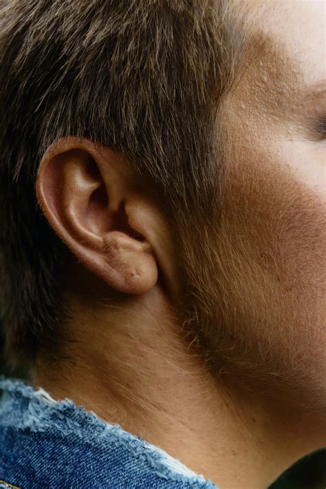 Should Swimmers Ear Drops Burn or Hurt? - OpenWaterHQ