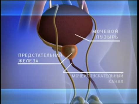 Лечение хронического простатита.