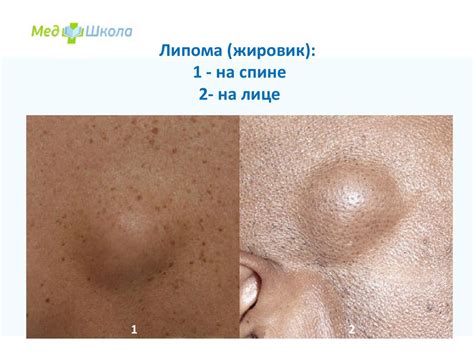 Образования кожи - презентация онлайн