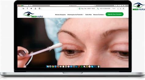 Melhor Pomada Para Cicatriz De Blefaroplastia - É hora de Pomada Cicatrizante - Cuidados após blefaroplastia - MedVisao ...