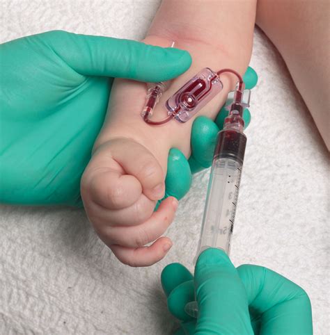 3 Essential Steps To Get It Right: The Art Of Drawing A Perfect Blood Culture