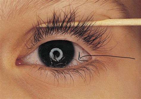 What Are Double Eyelashes? Let's See How Rare They Are!