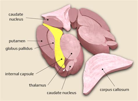 capsular warning syndrome stroke manual