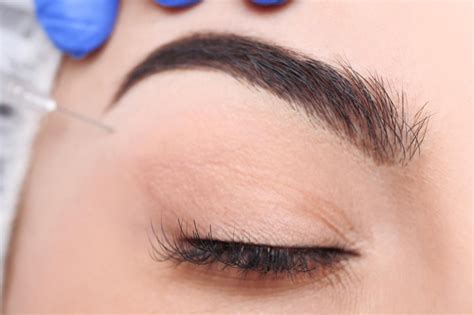 how to know if you have hooded eyelids