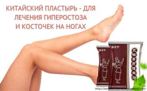 Лечение шишек на ногах | Центр травматологии и ортопедии. Обсуждение на ...