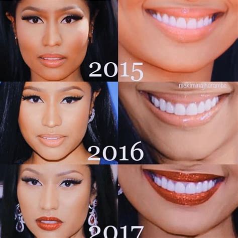 Albums 95+ Pictures Nicki Minaj Before And After Pictures Latest