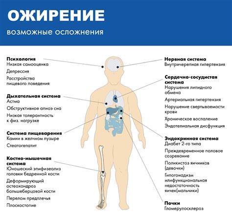 Абдоминальное ожирение: андроидное, по мужскому типу, яблоко, что такое ...