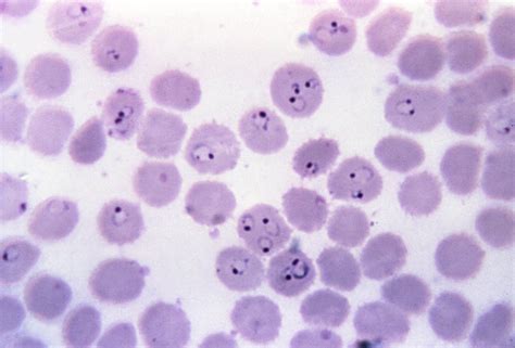 Bezplatný obrázok: Foto MIKROGRAFICKÉ, prsteň formulár, plasmodium
