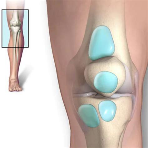 Bursitis Knee Pain - Carolinas Pain Center - Pain Relief Options