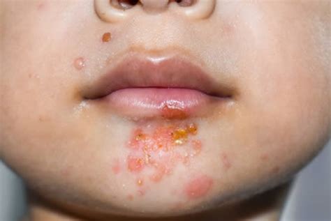 - Coast Dermatology & Skin Cancer Center