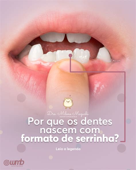 Internamente Os Dentes São Formados Principalmente Por Creatinina E Glutamina