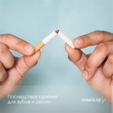 Последствия курения для зубов и десен Курение является одной из главных ...