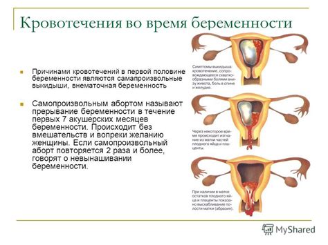 Презентация на тему: "Патологическое течение беременности, родов ...