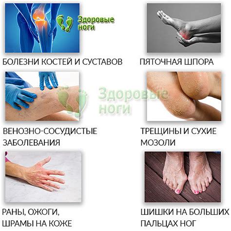Акулий жир для здоровья ног - полезные свойства и применение. Топ-10 ...