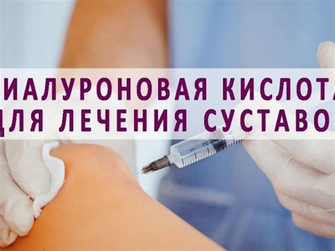 Гіалуронова кислота: препарати для суглобів у таблетках, ін'єкціях ...