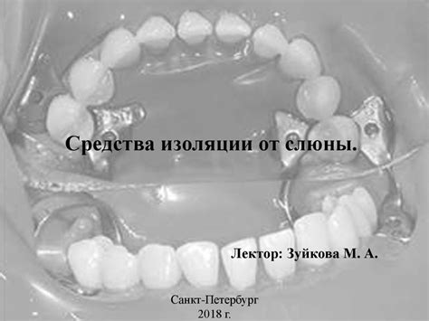 Средства изоляции от слюны в стоматологии - презентация онлайн