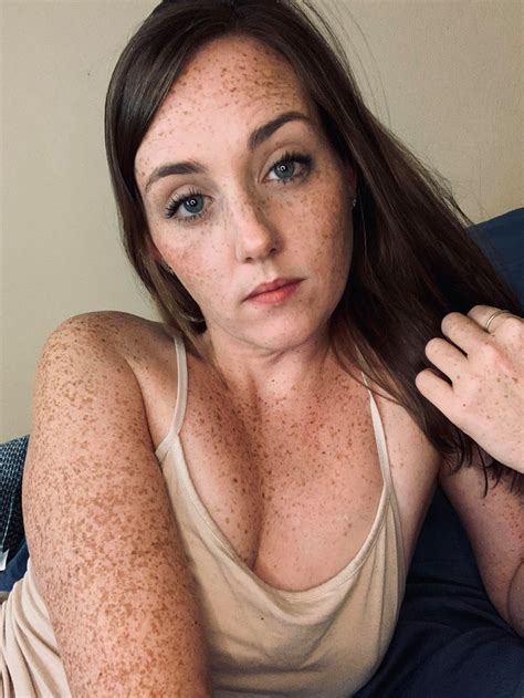 rarity_bee on reddit - So charming freckles