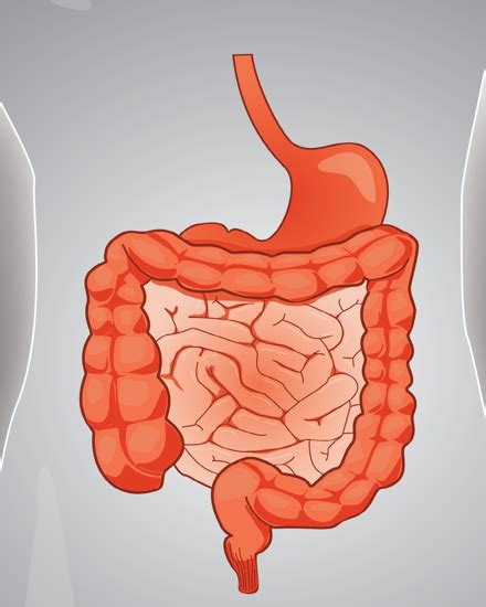 short bowel syndrome disease areas zealand pharma