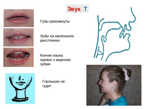 Постановка произношения звука Т, артикуляционная гимнастика