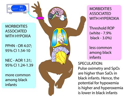 What Causes Pda In Babies at Tristan Wilkin blog