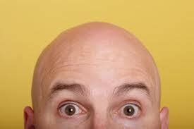 reasons  bald   stephen barker