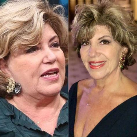 Silvia Poppovic Antes E Depois