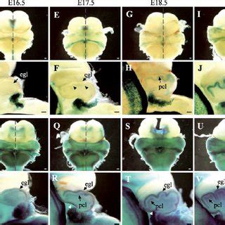 Abnormal development of the cerebellum in mutant mice lacking Shh ...
