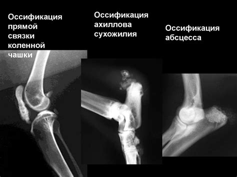 Рентгенологическая картина некоторых, редко встречающихся патологий ...